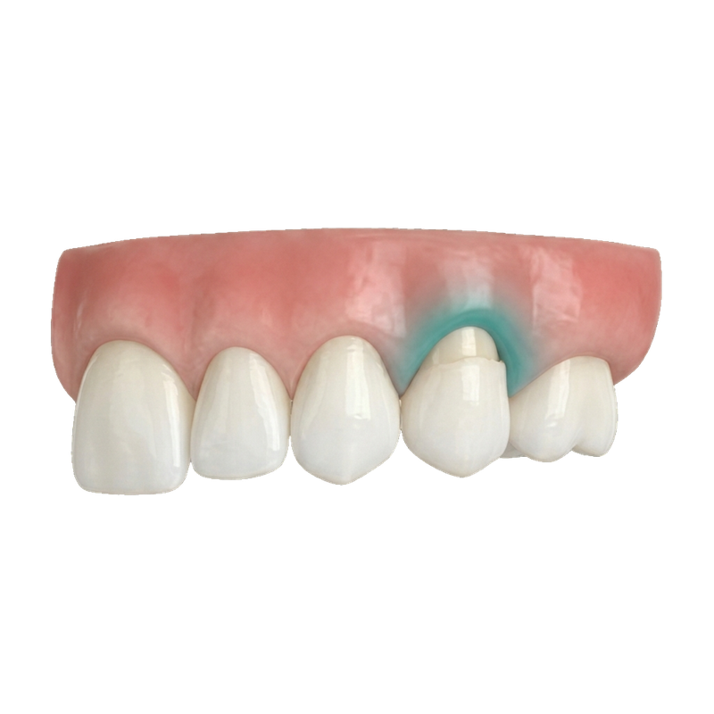 Modelo periodoncia y salud de encías